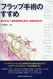 フラップ手術のすすめ