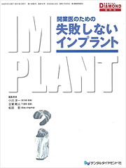 開業医のための失敗しないインプラント